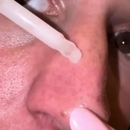 Peel Shot Glow Ris Ampul Duo af Wowgood